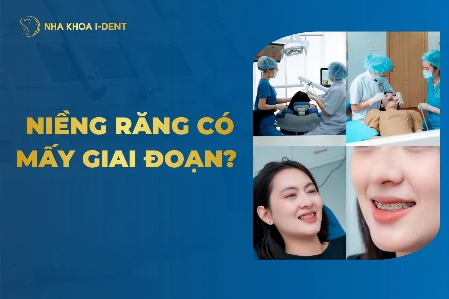 các giai đoạn niềng răng