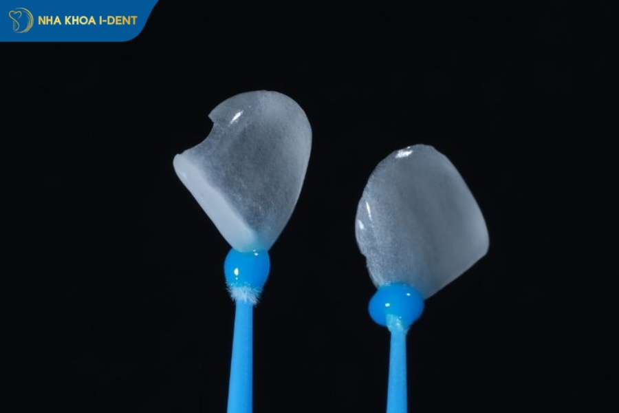 dán sứ răng cửa giá bao nhiêu
