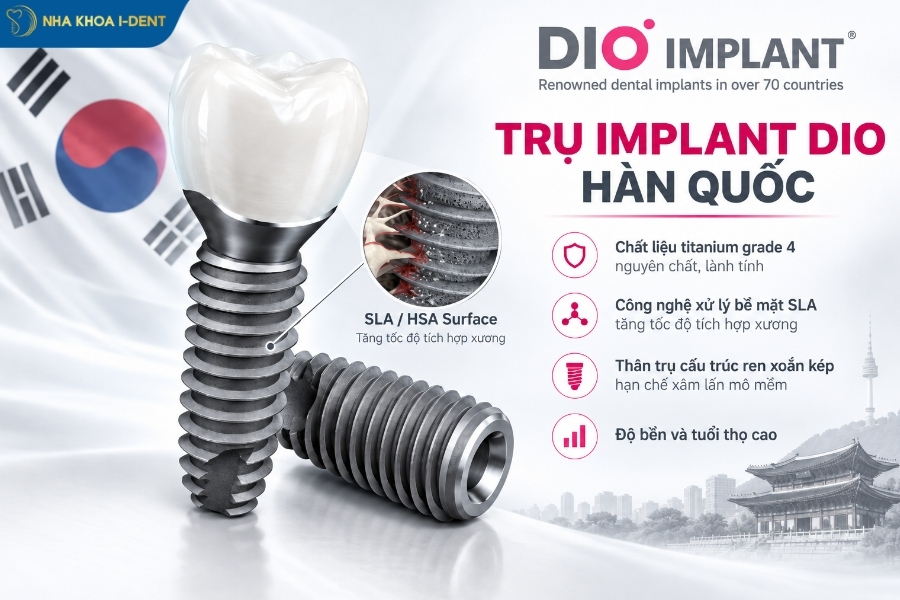 biotem implant - Nha khoa I-Dent
