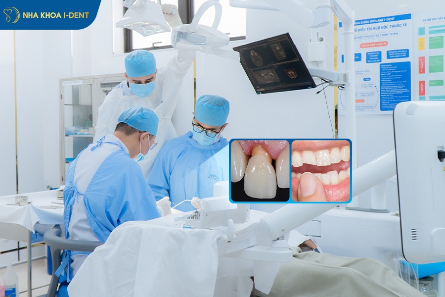 gãy răng cửa hàm trên