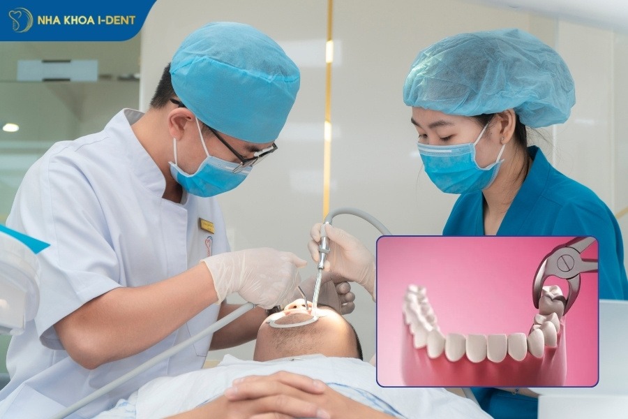 giá nhổ răng sâu