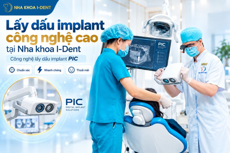 lấy dấu implant tại nha khoa i-dent