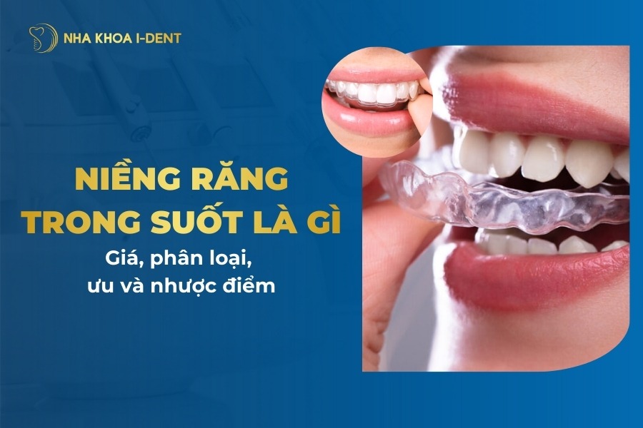 Niềng răng trong suốt là gì? Chí phí, phân loại, ưu và nhược điểm