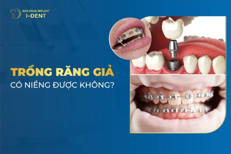 Trồng Răng Giả Có Niềng Được Không? - Nha khoa I-Dent