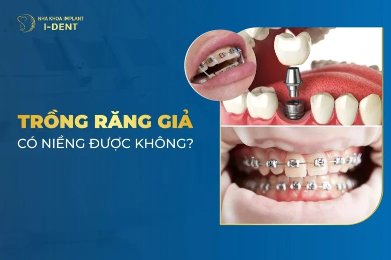 Trồng Răng Giả Có Niềng Được Không? - Nha khoa I-Dent