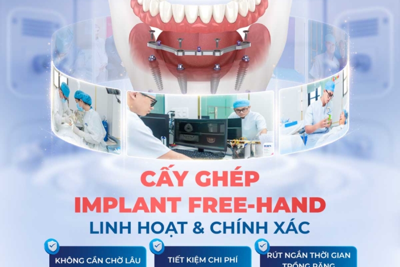 Trồng Răng Implant Toàn Hàm Với Kỹ Thuật Free-Hand: Giải Pháp Linh Hoạt, Chính Xác