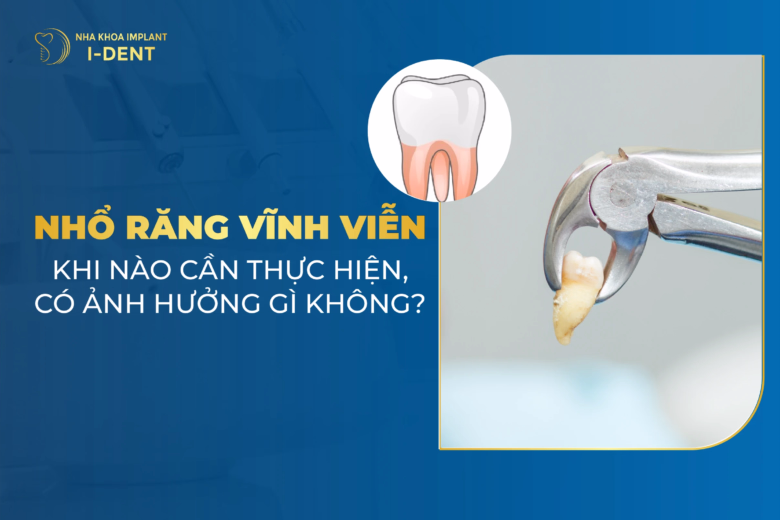 nhổ răng vĩnh viễn