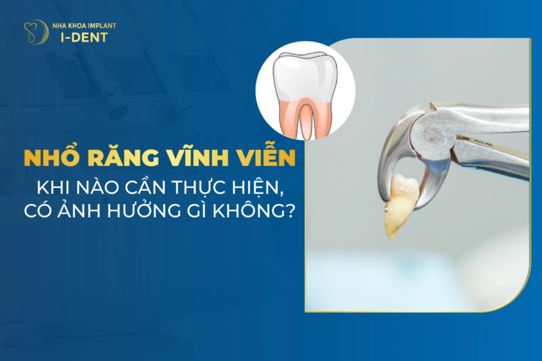 Nhổ Răng Vĩnh Viễn: Khi Nào Cần Thực Hiện, Có Ảnh Hưởng Gì Không?