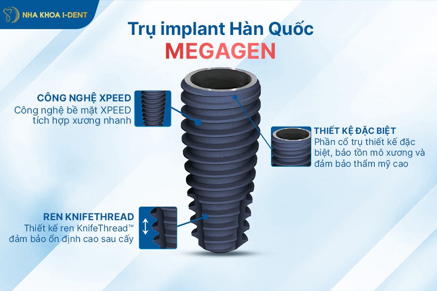 các loại trụ implant Hàn Quốc