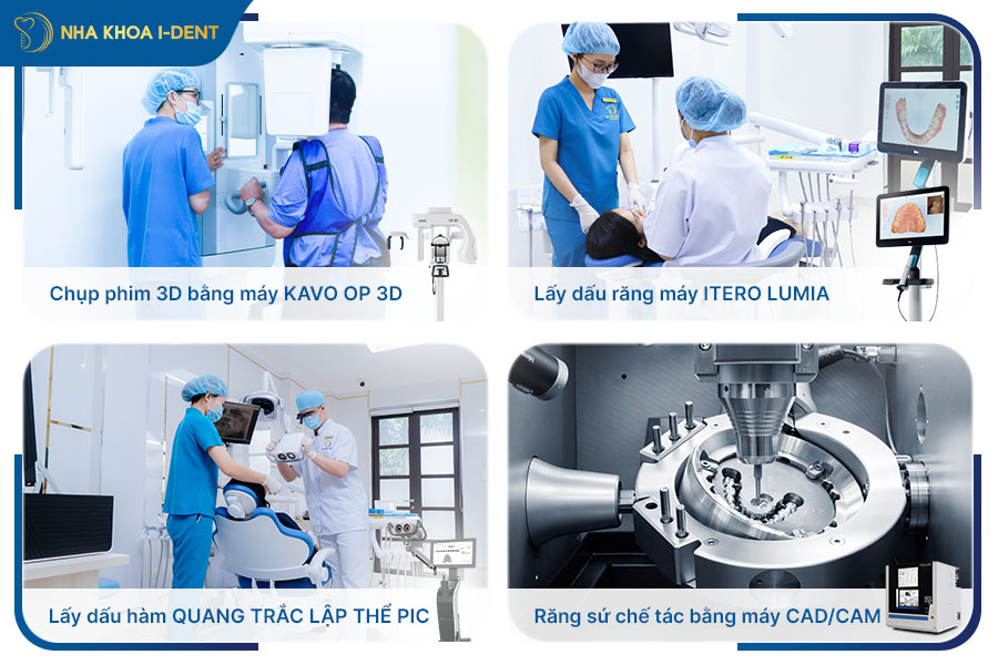 cấu tạo răng implant