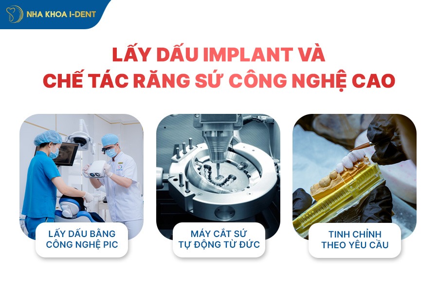 cấy implant mất bao lâu