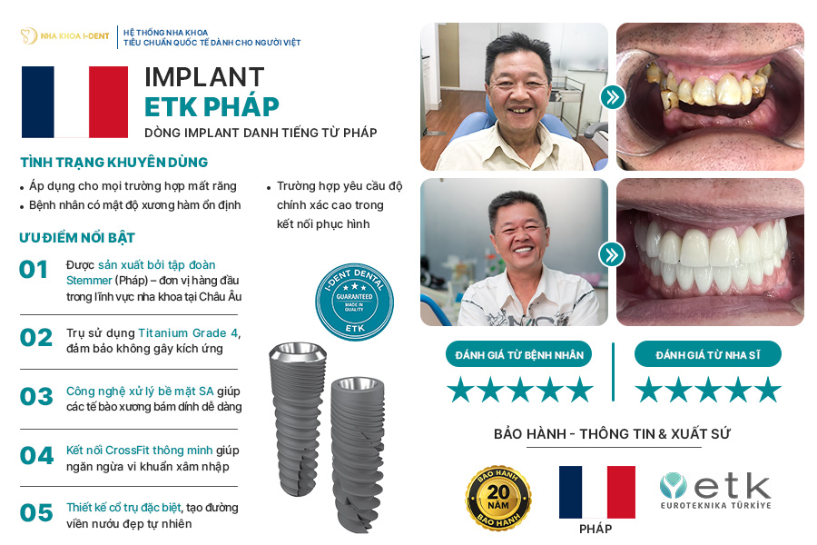 etk implant - Nha khoa I-Dent