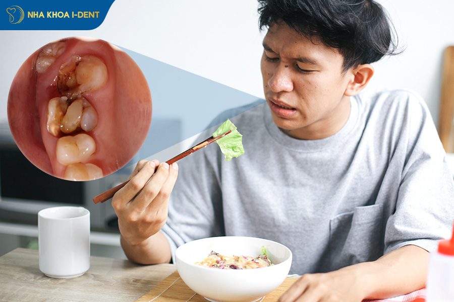 gãy răng hàm trên có mọc lại không