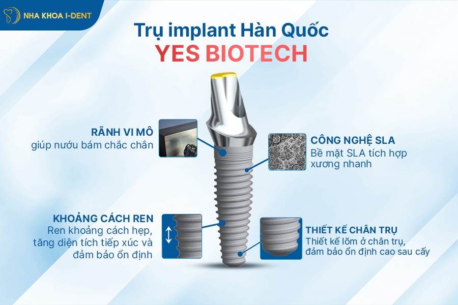 giá implant hàn quốc
