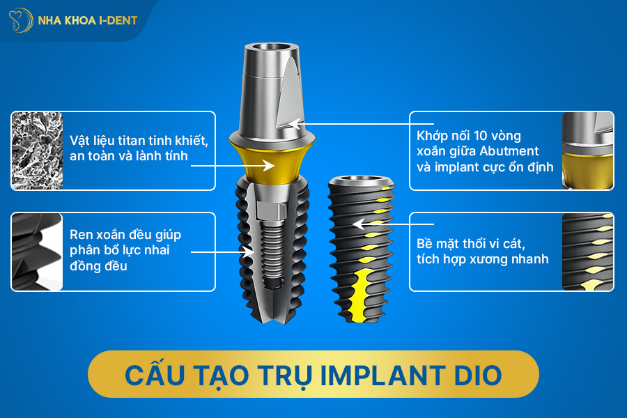 giá trồng răng implant hàn quốc
