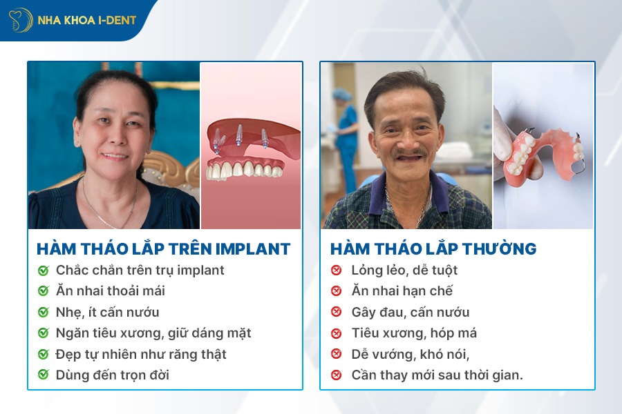 làm răng hàm giả tháo lắp giá bao nhiêu
