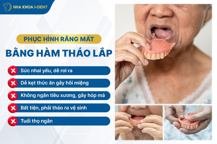 mất răng hàm có bị sao không