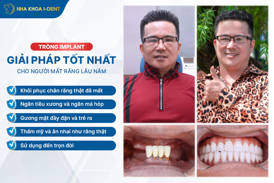 mất răng lâu nam