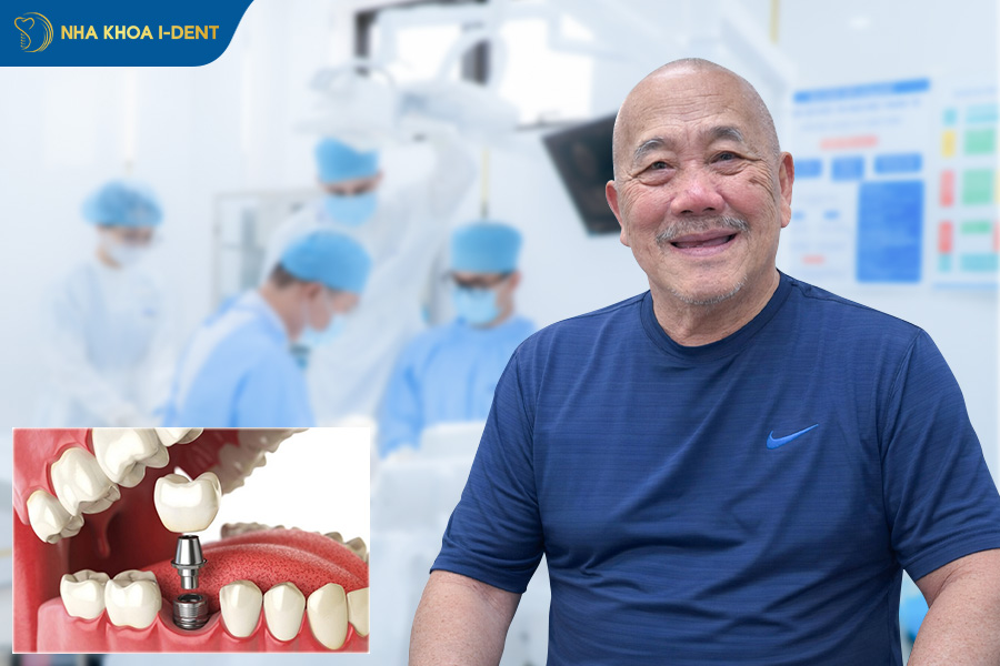 nhổ răng bao lâu thì trồng implant