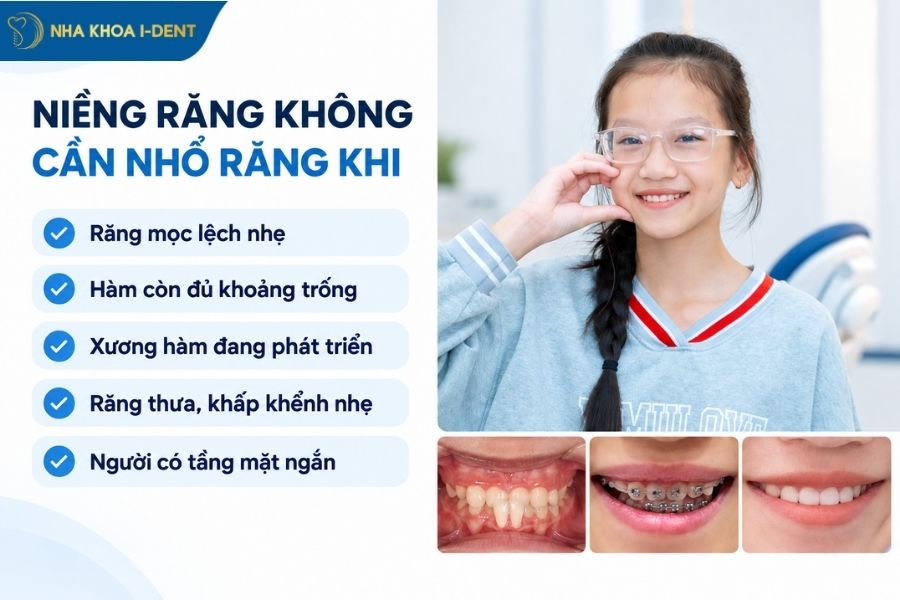 khi niềng răng có phải nhổ răng không