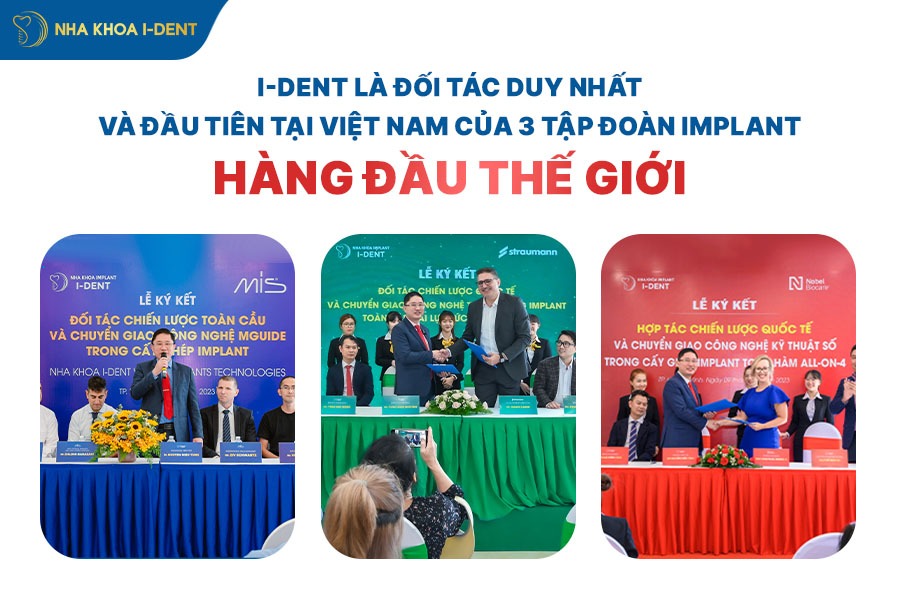 thời gian cấy ghép implant
