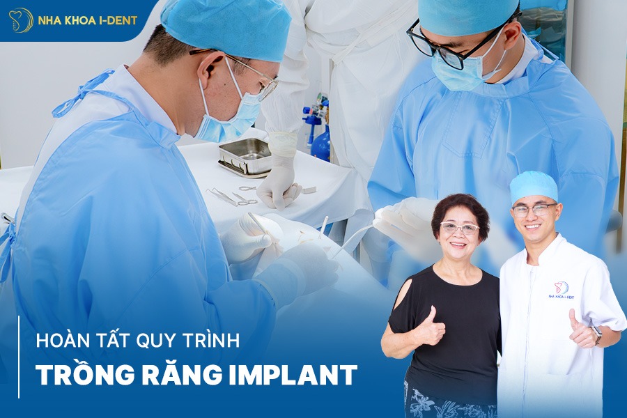 thời gian trồng răng implant