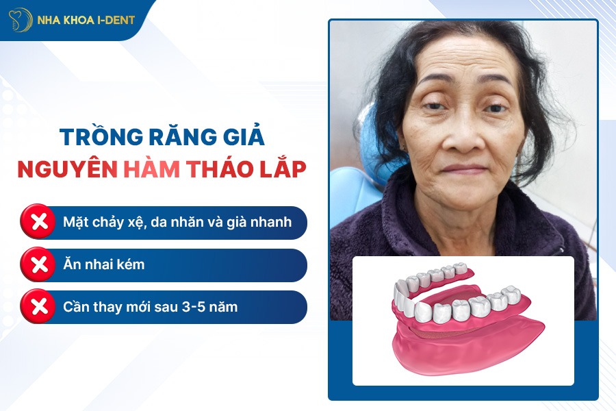 trồng răng nguyên hàm