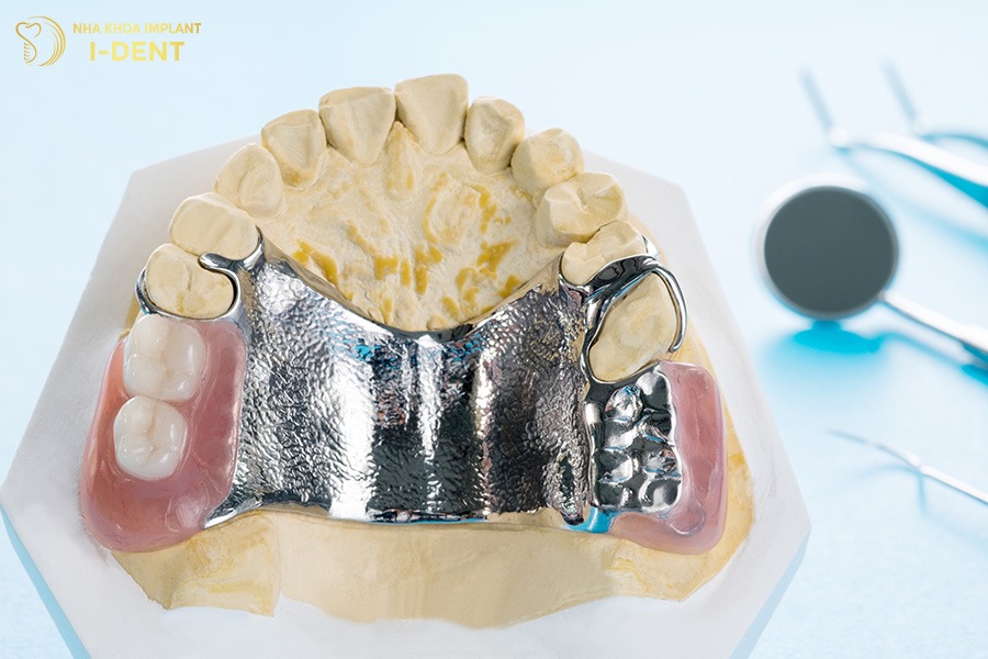 trồng răng giả tháo lắp