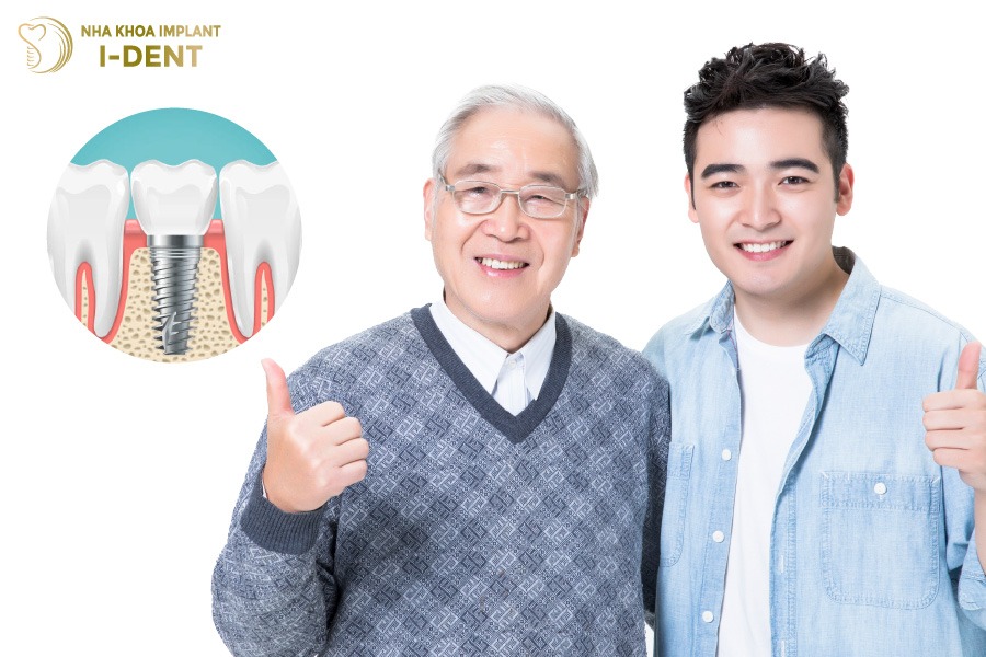 Trụ Implant Mỹ bền chắc và có tuổi thọ cao