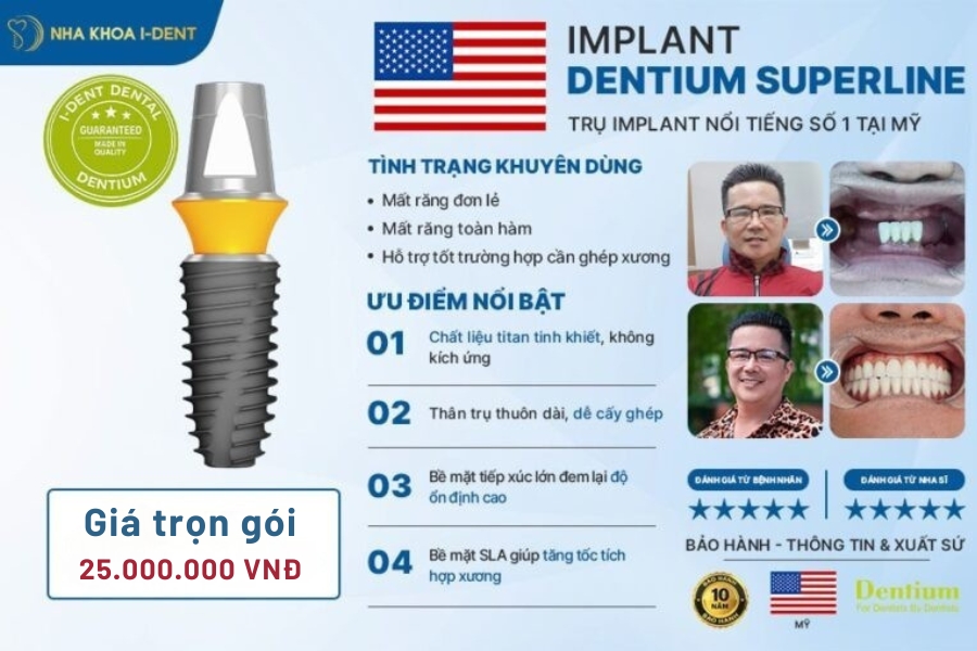 implant mỹ - Nha khoa I-Dent