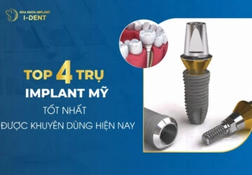 Top 4 Dòng Trụ Implant Mỹ Được Ưa Chuộng Nhất Hiện Nay