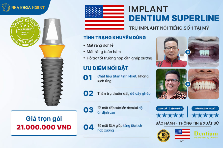 trụ implant mỹ