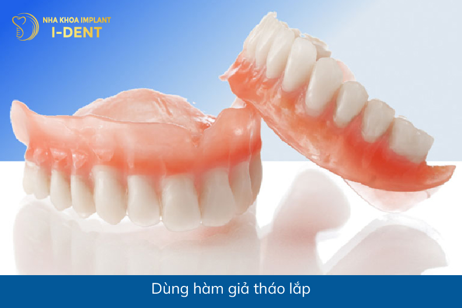 Dùng hàm giả tháo lắp mất răng ở hàm dưới