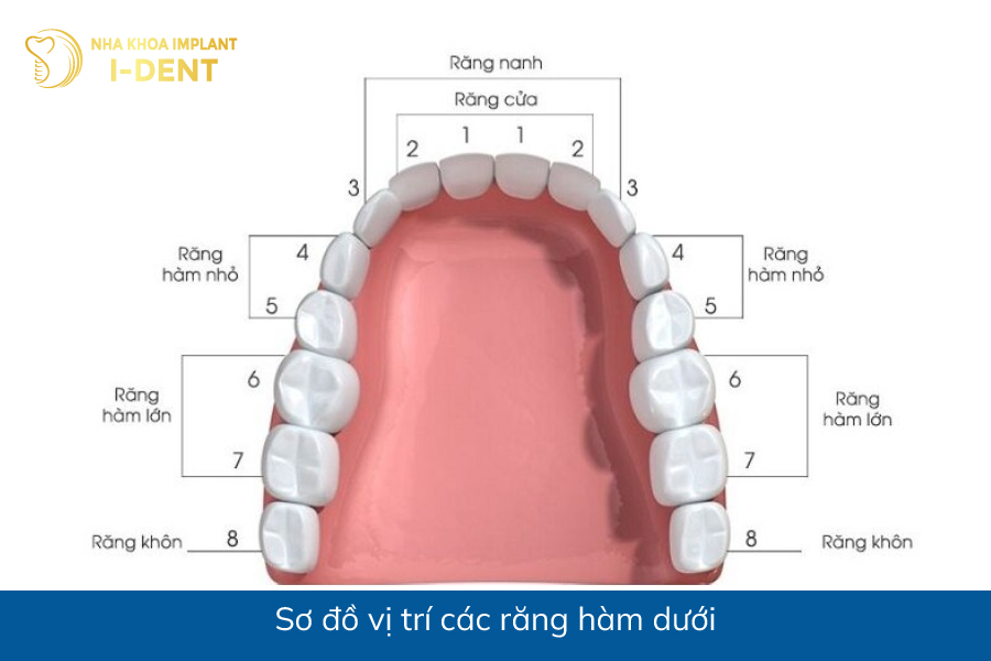 Sơ đồ vị trí các răng hàm dưới mất răng hàm dưới