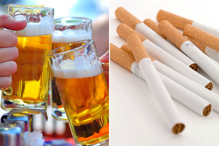 Không hút thuốc, uống rượu bia trước và sau khi ghép xương trồng răng khi bị tiêu xương