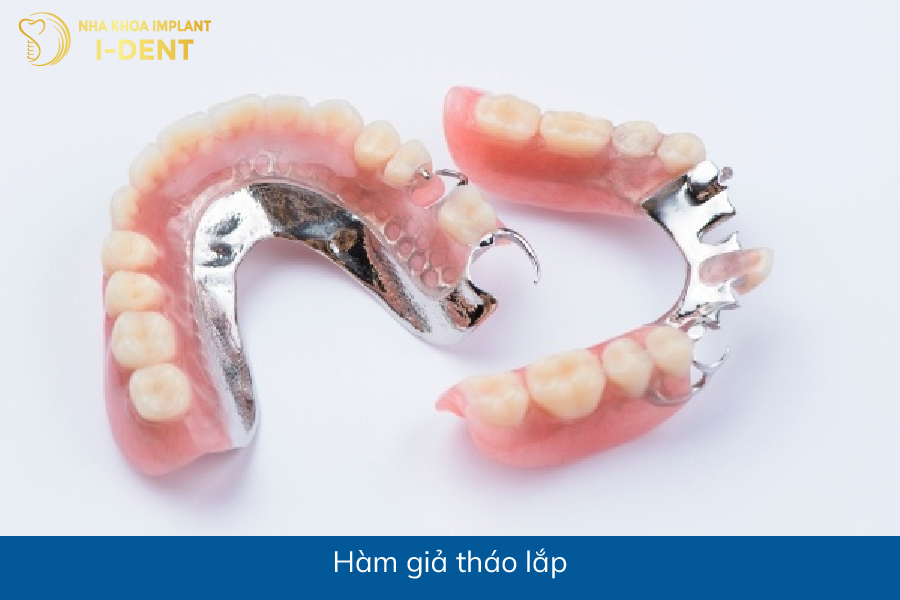 Làm hàm giả tháo lắp bị mất răng thì phải làm sao