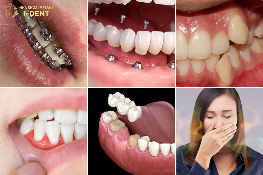 Máy tăm nước phù hợp với nhiều đối tượng tác dụng của tăm nước