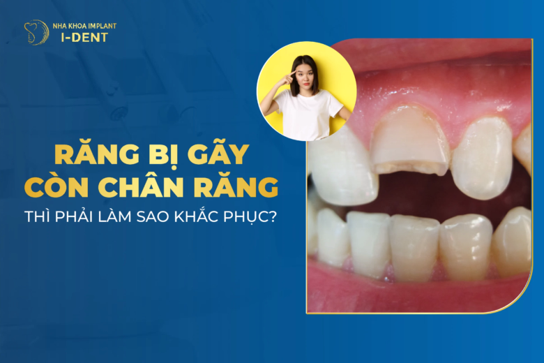 Răng bị gãy còn chân răng thì phải làm sao khắc phục?