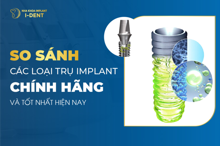 so sánh các loại trụ implant