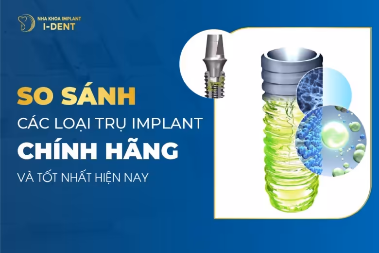 so sánh các loại trụ implant
