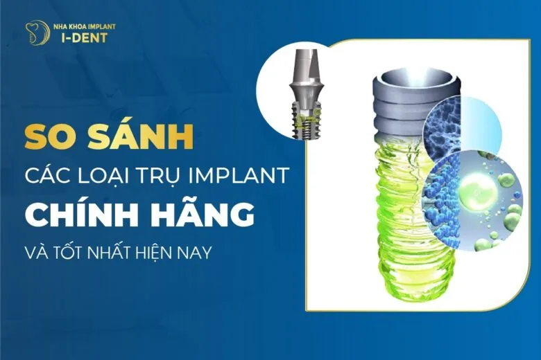 so sánh các loại trụ implant