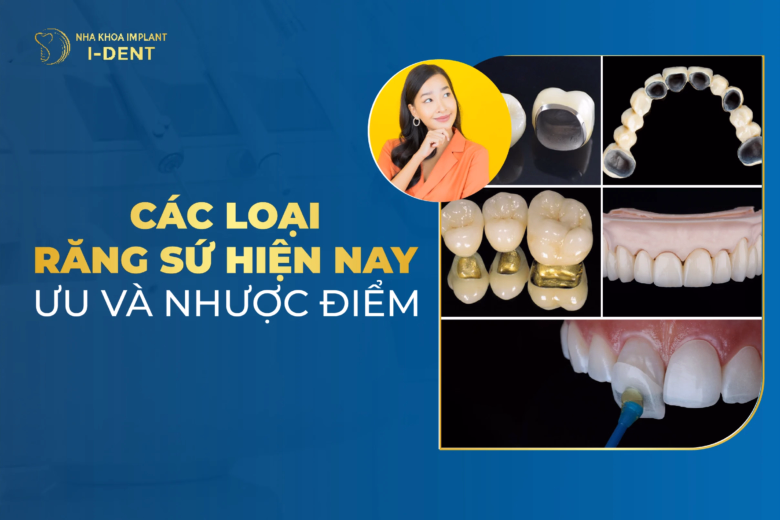 các loại răng sứ hiện nay