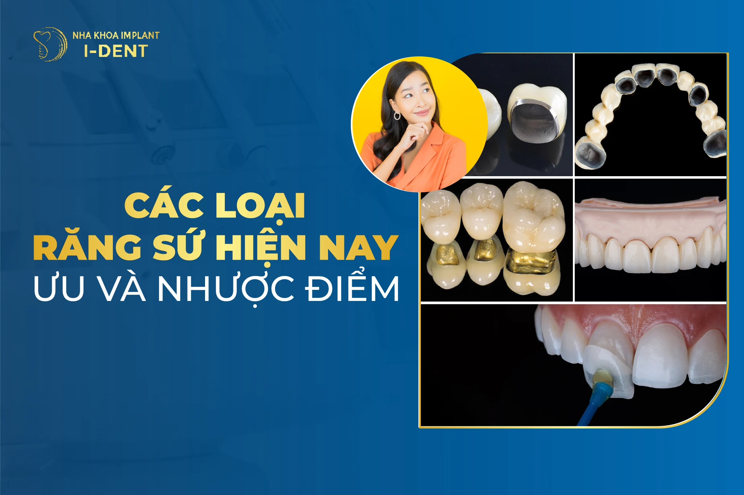 Răng sứ có mấy loại? Ưu nhược điểm từng loại chi tiết