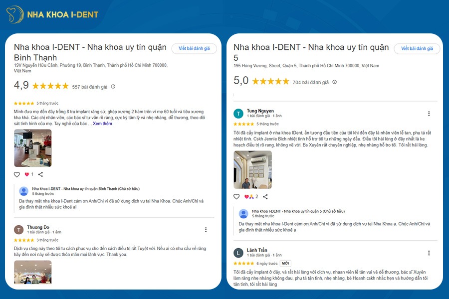 cắm implant ở đâu tốt