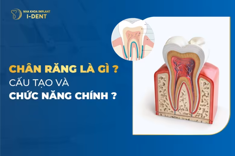 chân răng
