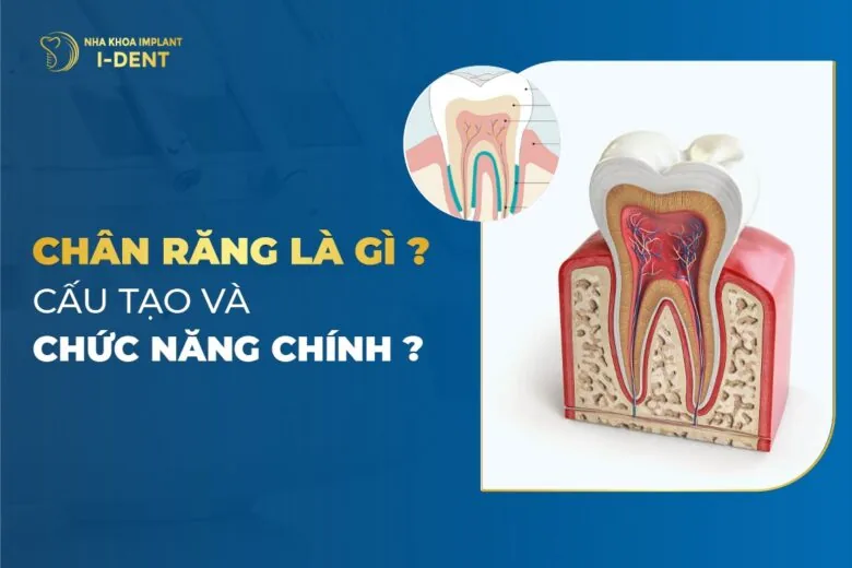chân răng