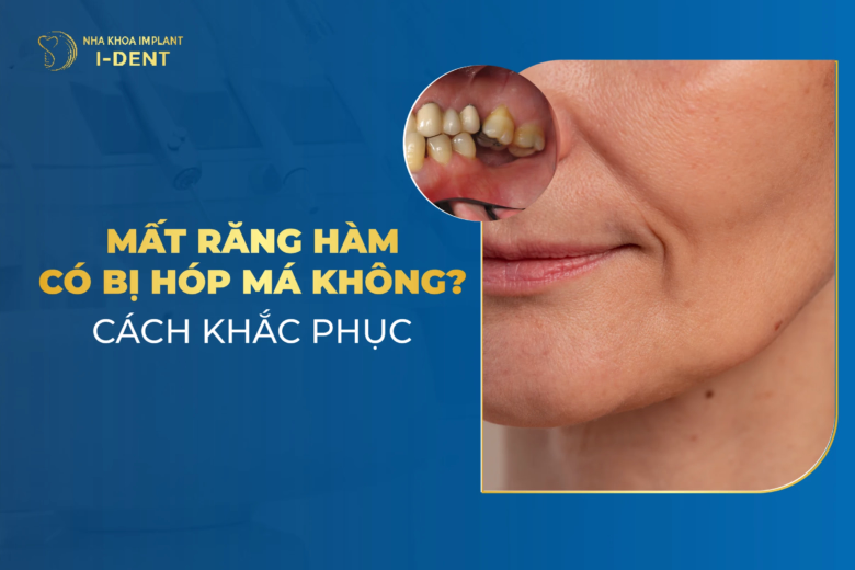 Mất răng hàm có bị hóp má không? Cách khắc phục