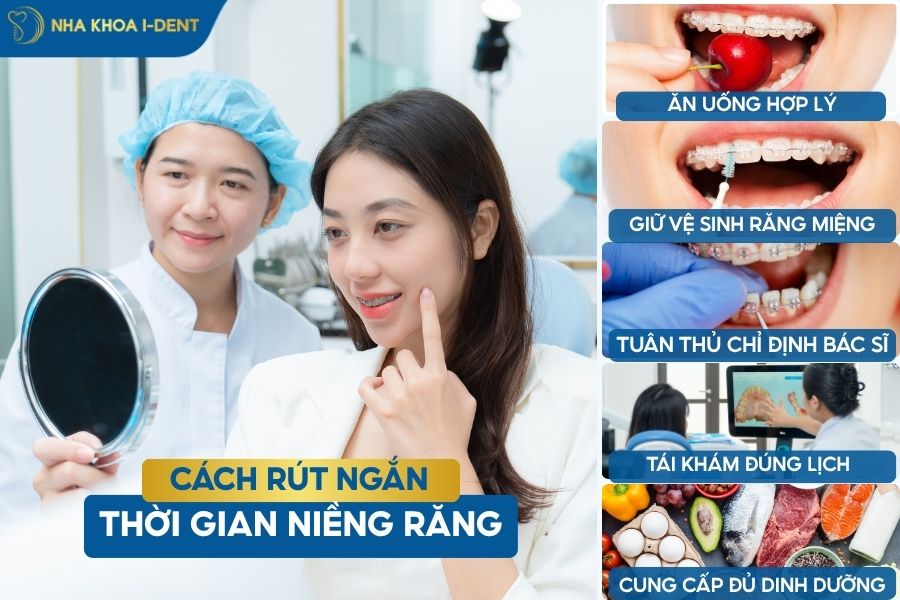 niềng răng bao lâu thì xong
