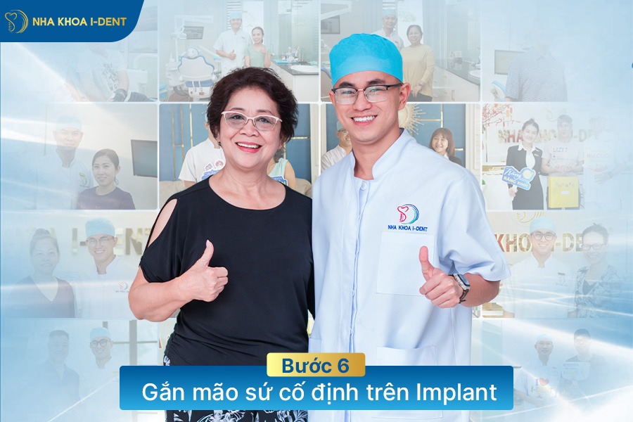 quá trình trồng răng implant