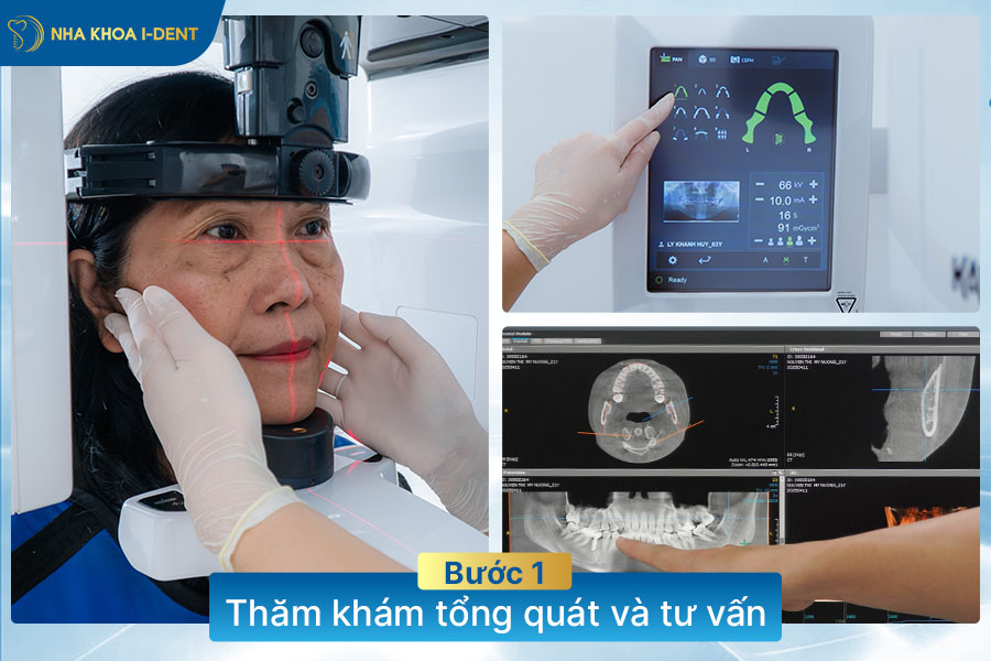 quy trình cấy ghép implant